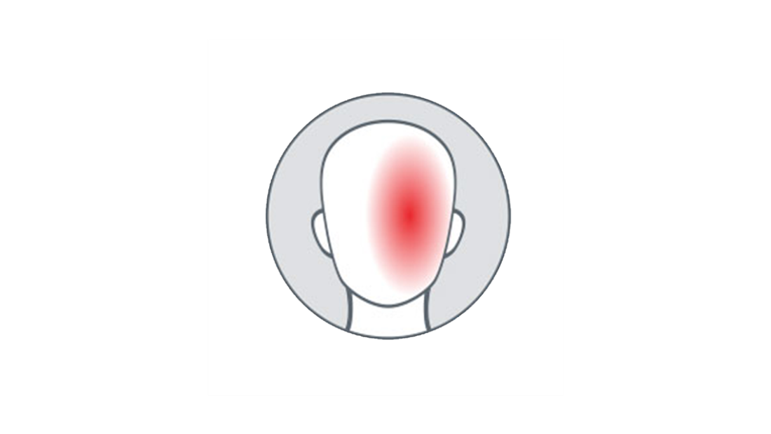 Migrénové bolesti hlavy